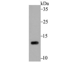 PSENEN/PEN2 Antibody (JE41-28), Novus Biologicals 100 &mu;l; Unconjugated:Antibodies,